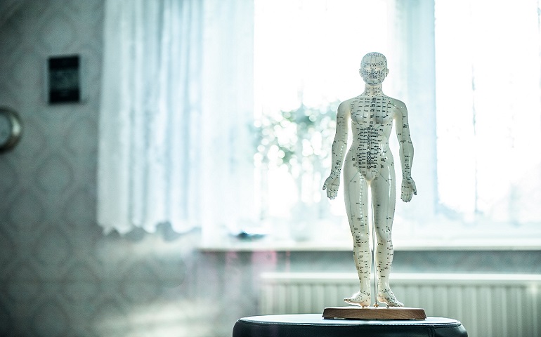 edmonton acupuncture pain management